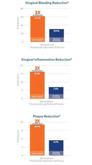 Waterpik® Sonic-Fusion®: Twice as Effective as Regular Brushing & Flossing for Removing Plaque and Improving Gingival Health